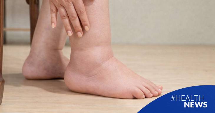 6-de-marzo-dia-internacional-del-linfedema