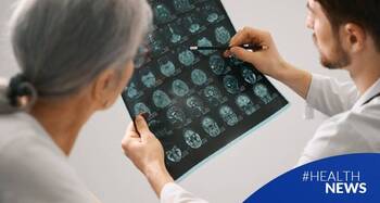 Nuevo fármaco contra el Alzheimer que reduce la inflamación del cerebro: ¿qué se vislumbra en el horizonte?
