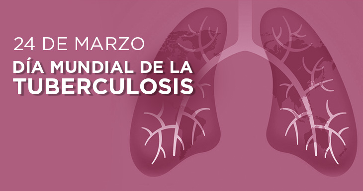 Tuberculosis. En tiempos del Coronavirus, una enfermedad antigua que no debemos desatender